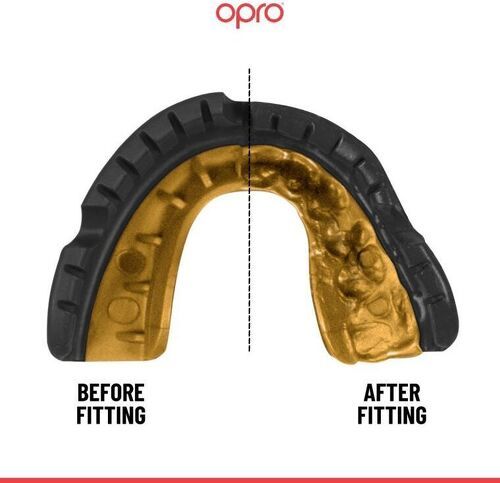 OPRO-Protège Dents Opro Gold Braces V2-3