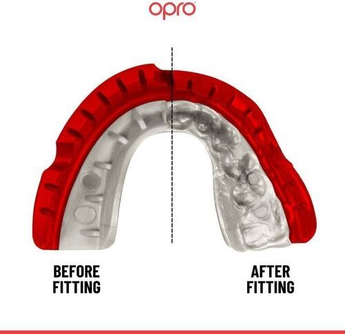 OPRO-Protège Dents Opro /Blanc Gold Braces V2-3